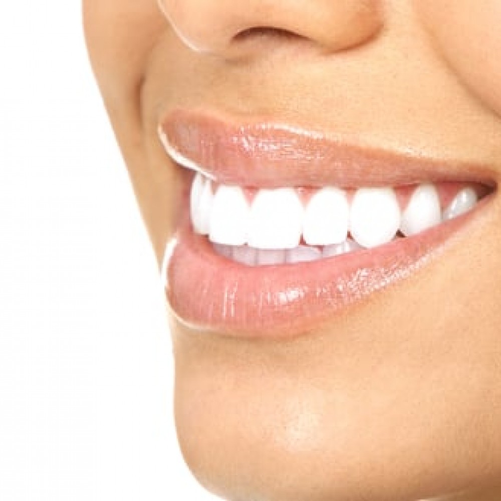 Cosmetic dentistry